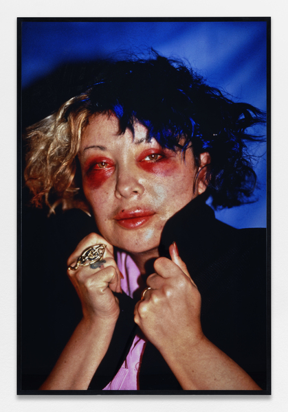 Portrait fait par la machine-corps quatre jours après la 7ème opération chirurgicale-performance, Dites omniprésence 25/11/1993